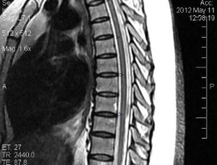 Magnetic resonance imaging of the thoracic spine