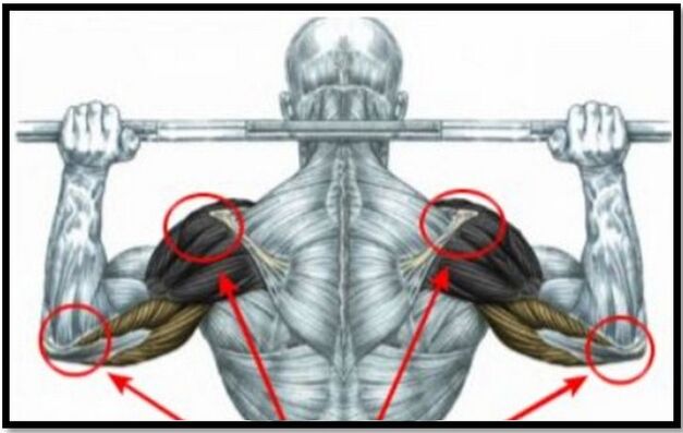 The load on the shoulder and elbow muscles is one of the causes of arthrosis of the shoulder joint