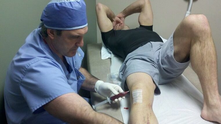 Treatment of knee articulation arthrosis